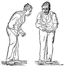 Illustration of the Parkinson Disease